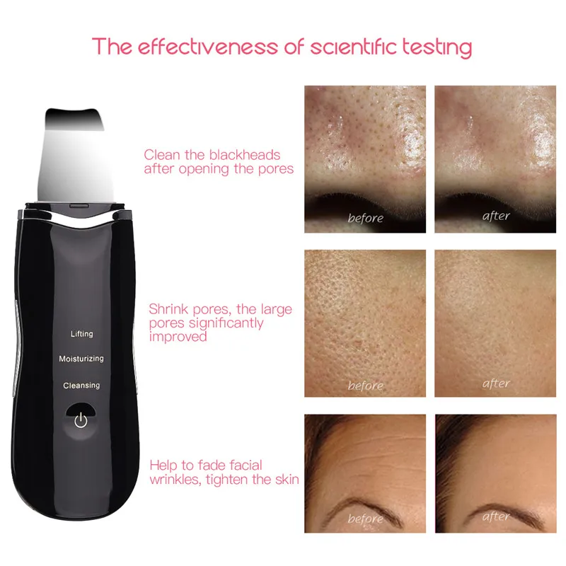US $20.78 Professional Ultrasonic Facial Skin Scrubber Vacuum Blackhead Remover Tool Pore Cleaner Facial Diamond Dermabrasion Machine 47