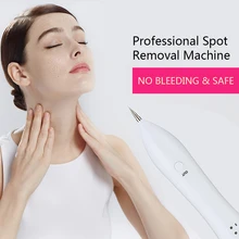 Лазерная машина для удаления веснушек, уход за кожей, инструмент для красоты, удаление молей, удаление темных пятен для лица, бирки для бородавок, татуировка, ручка Remaval