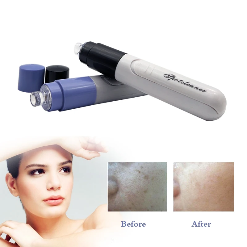 Pore cleaner9