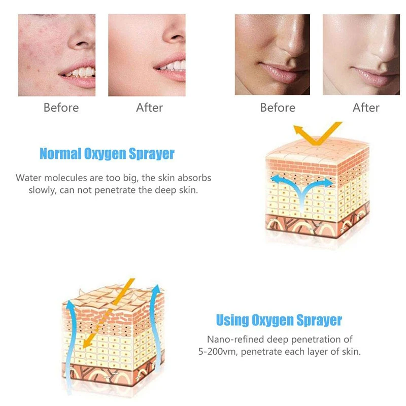 Королева красоты спрей кислород инъекции воды гидратный прибор машина красоты омоложение кожи кислород инфузионный спа для лица Уход