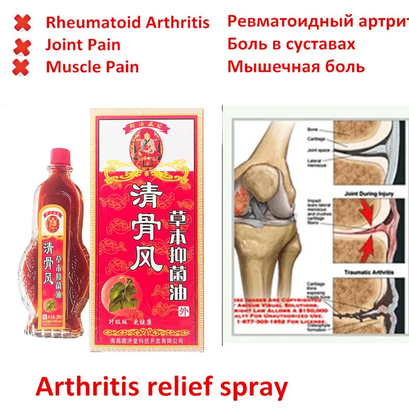 Китайская травяная медицина мазь от боли в суставах Привет. Бальзам дымовой артрит, ревматизм, лечение миалгии 15 мл