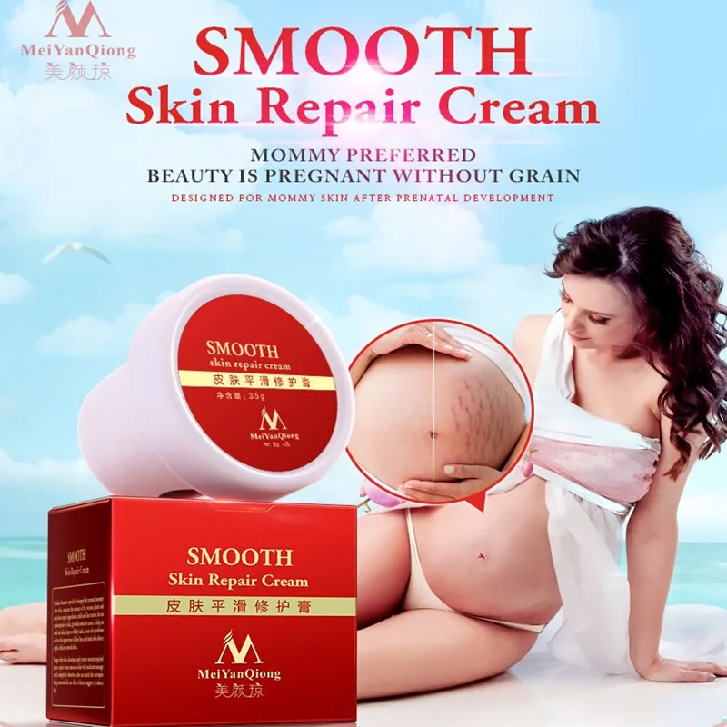 Smooth Skin Repair Body moisturizer Cream stretch marks remover moisturizing lightening whitening Scar Removal Postpartum Care Smooth Skin Repair Body moisturizer Cream stretch marks remover moisturizing lightening whitening Scar Removal Postpartum Care