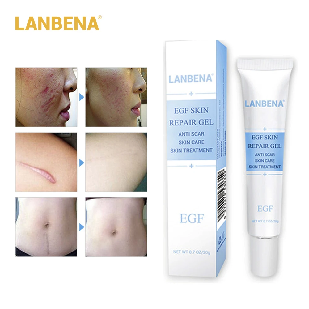 LANBENA EGF Remover Scar Cream Stretch Mark Gel Anti Acne Cream Acne