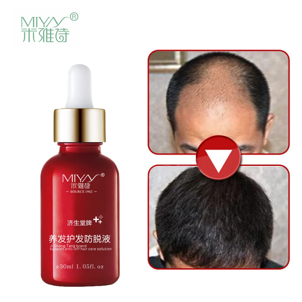 Hair Oil Hair Care Fast Powerful Hair Growth Products Regrowth