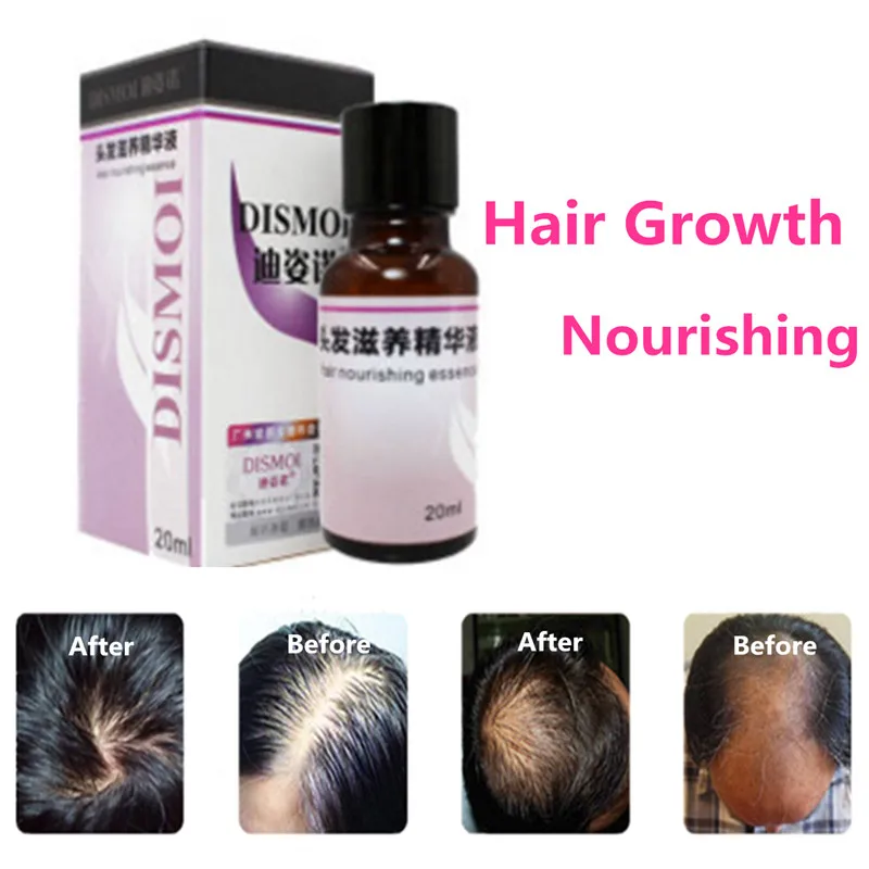 Hair Growth Anti Loss Liquid 20ml Dense Hair Fast Sunburst Hair Growth Nourishing Essence Hairs Regrowth Treatment Serum