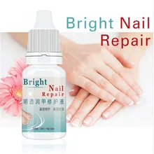 1 шт., средство для лечения Ногтей, жидкое питательное масло, противогрибковое средство для восстановления ногтей, Яркий палец, грибок, антибактериальное удаление, онихомикоз