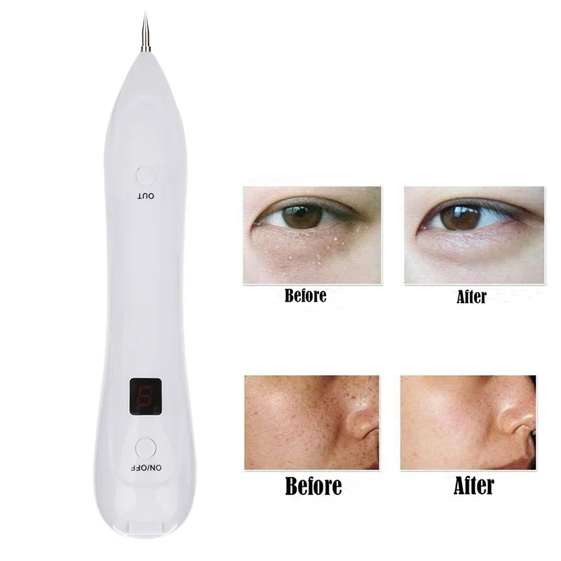 Freckle Point Mole Pen Fashion ABS Scars Removal Effective Nevus White Face Cosmetic Instrument | Красота и здоровье