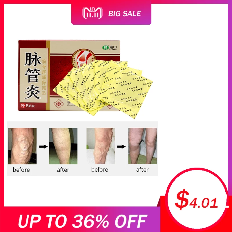 Aliexpress.com : Buy 24PCS Chinese Traditional herbal medicine Patches