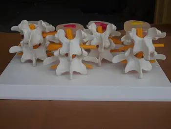 

Human skeleton model lumbar disc disease model spine model lumbar bone lesions Model