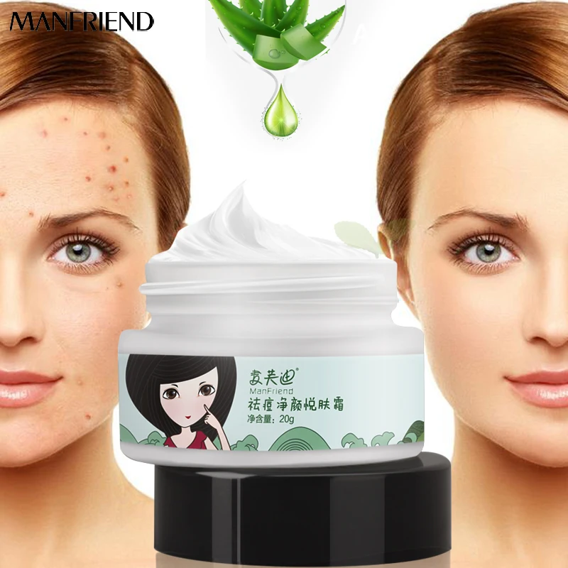 

Acne Cleaning Cream Skin Care Remove Repair Comedone Pimple Acne Quickly Face Acne Cream Remover Anti Acne Treatment Shrink Pore