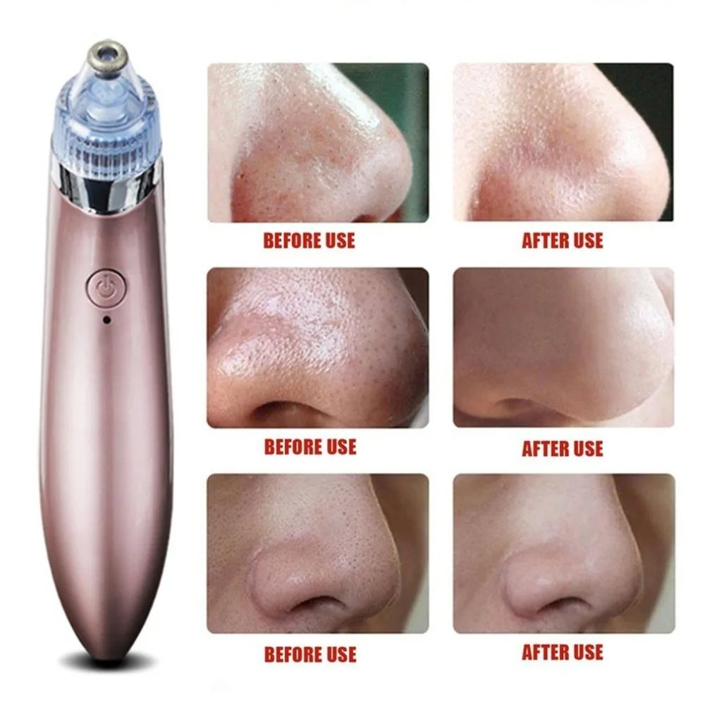 Electric-Mini-Handheld-Dead-Skin-Acne-Vacuum-Suction-Blackhead-Removal-Face-Lifting-Skin-Tightening-Beauty-Cleansing (4)