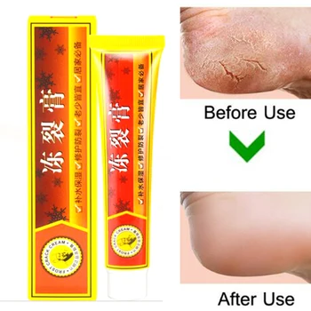 

Powerful Hand Foot Crack Cream Heel Chapped Peeling Foot and Hand Repair Anti Chapping Wrinkle Treatment Skin Cracking D197