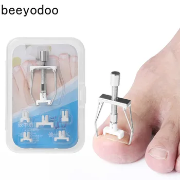 

Orthotic Nail Corrector Pedicure Tool Ingrown Toe Nail Recover Correction Tool Pedicure Toenail Fixer Foot Nail Care Tool