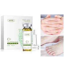 20 мл масло грибка для ногтей бактерии Уход за ногтями лечение противогрибковые инфекция ногтей ремонт ногтей E1