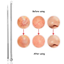 3 набора для удаления угрей, акне игла прыщей, инструмент для удаления пятен, черная головка, очиститель пор, глубокий инструмент для очищения кожи, красота, уход за кожей