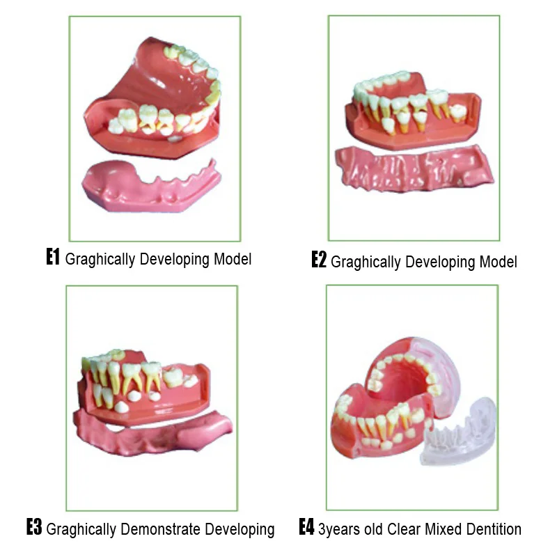 Зубные молочных зубов разработки модели и ОРТО зубы анестезии модель извлечения корневого канала модель