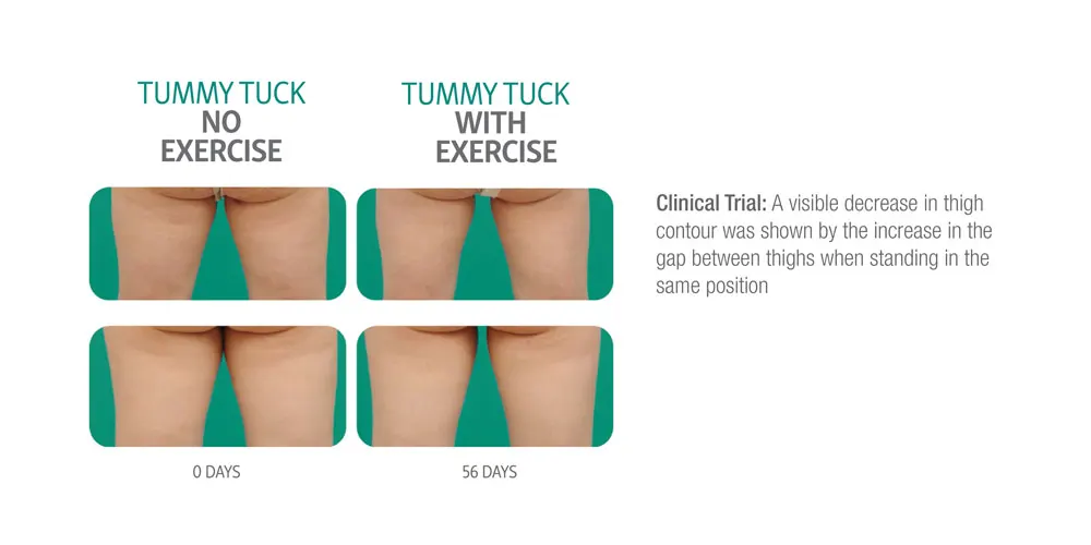 tummy-tuck-banner-2