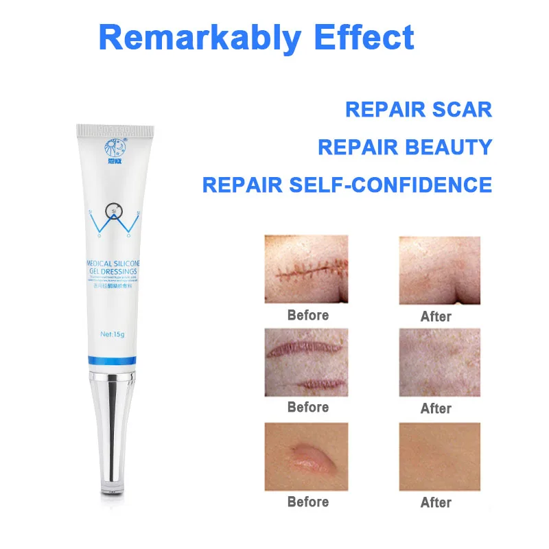 Scar Removal Cream Safe Effective Medical Silicone Acne Scars Gel Flatten Repair Burn C-Section Keloid Scars Treatment Face Body