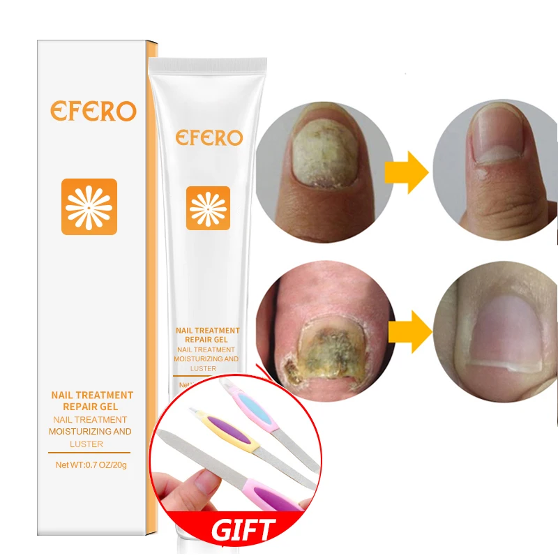 Efero восстанавливающая эссенция для ногтей Сыворотка для ногтей Уход восстановление грибок ногтей носок питательная сыворотка удаление онихомикоза Уход за ногтями гель эссенция