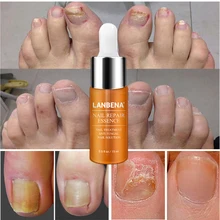 Горячая бренд LANBENA Лечение ногтей для восстановления ногтей эссенция питательное масло для пальцев ног питательное осветление рук и ног