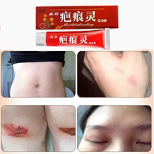 Особенно сильный тип уход за лицом шрам крем уход за кожей для удаления шрамов Крем для лечения шрамов и шрамов