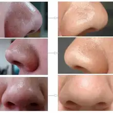 10 шт. травяная Глубокая очистка пор на носу полоски черные инструменты для ухода за лицом горячей МДФ