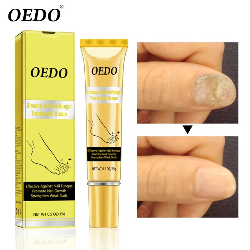 15g Ginseng Nail Treatments Cream Natural Herbal Removal Nail Fungus Anti Infection Nail Care Cream