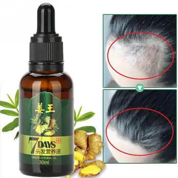 

Hair Growth Essence Ginger Natural Plant Extract Anti Hair Loss Treatment Liquid Pilatory