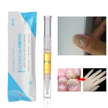 1 шт., Профессиональная жидкая ручка для лечения грибковых ногтей, яркие ногти, ремонт пальцев и пальцев ног, онихомикоз, эссенция для удаления, инструмент для ухода за ногами