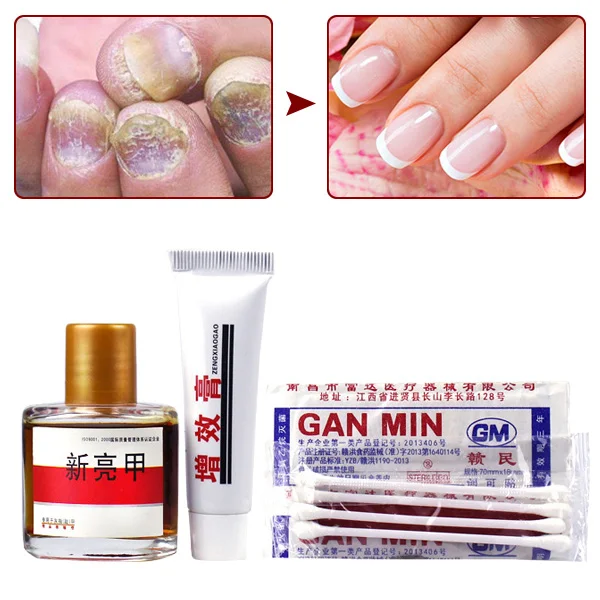 Nail Fungal Treatment Set Onychomycosis Removal Anti Fungus Toenail Nails Care Repair Liquid 25ml HJL2018