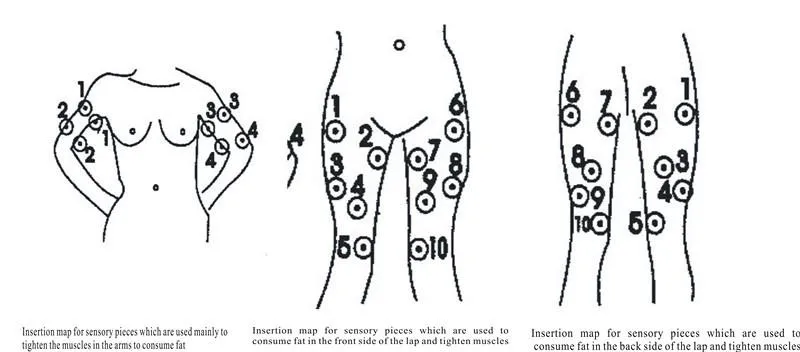 Точки эрба для миостимуляции схемы с цветными электродами
