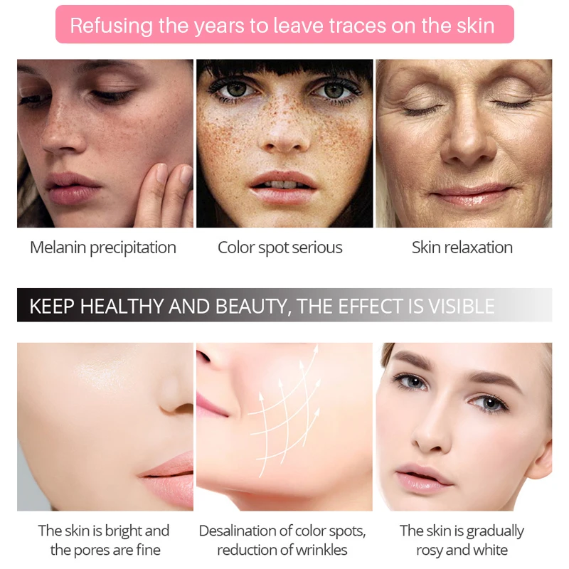 efero Face Cream Whitening Skin Repair Freckles Cream Remove Dark Spots Acne Melanin Remover Brightening Face Cream Moisturizing