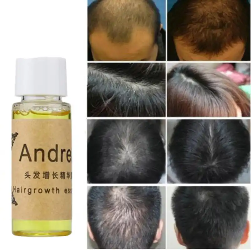 Andrea Hair Growth Anti Hair Loss Liquid 20ml 100 Natural Extract