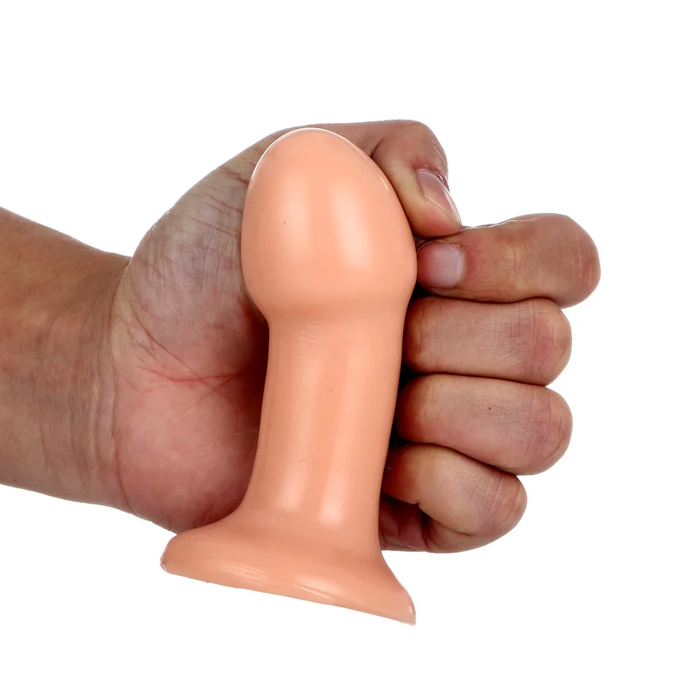 anal (3)