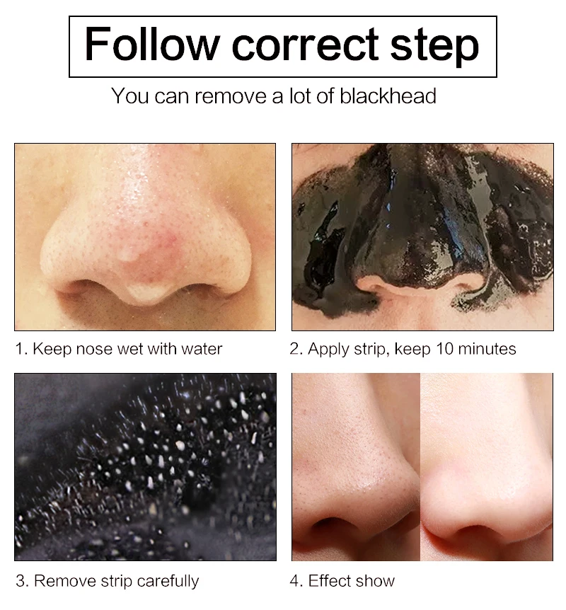 blackhead_08