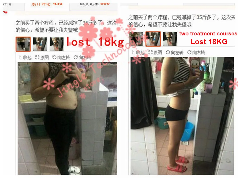 Weight Loss Products Patch Minceur Emagrecimento Queimar Gordura Fat Dieet Parches Adelgazantes Afvallen Slim Patch For Slimming (7)