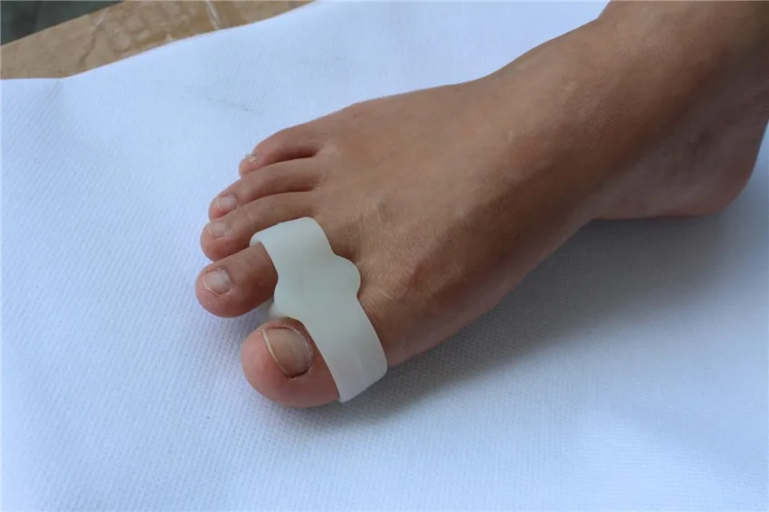 toe separator02