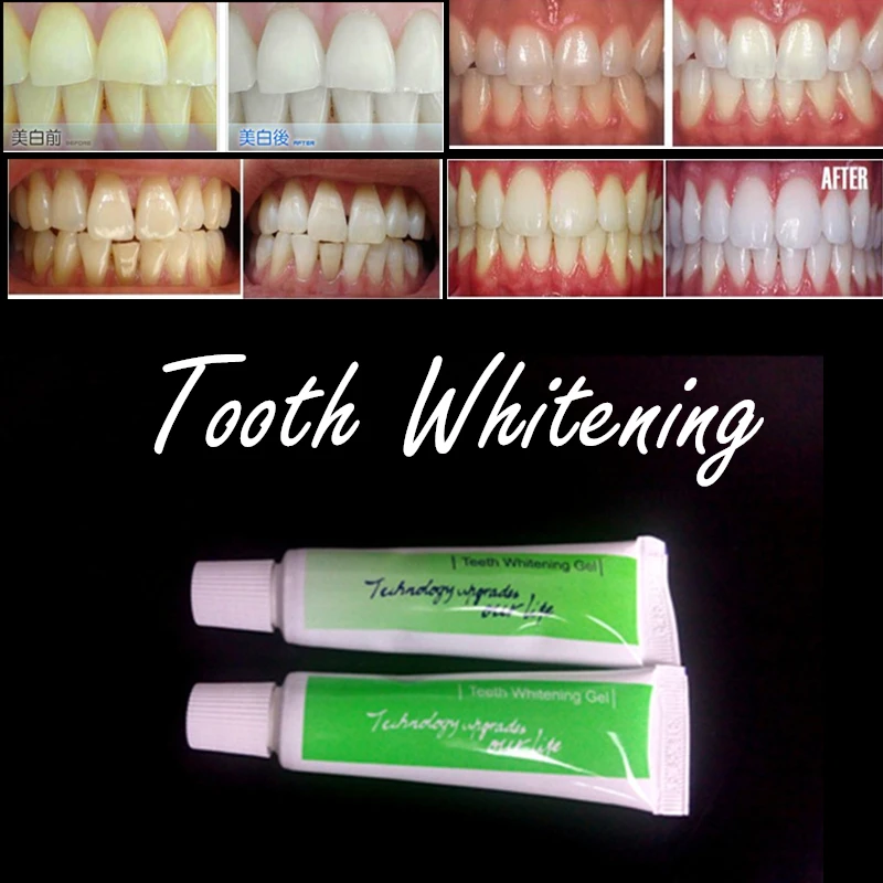 Buy 2pcs FDA standard Teeth tooth Fast Whitening Gel