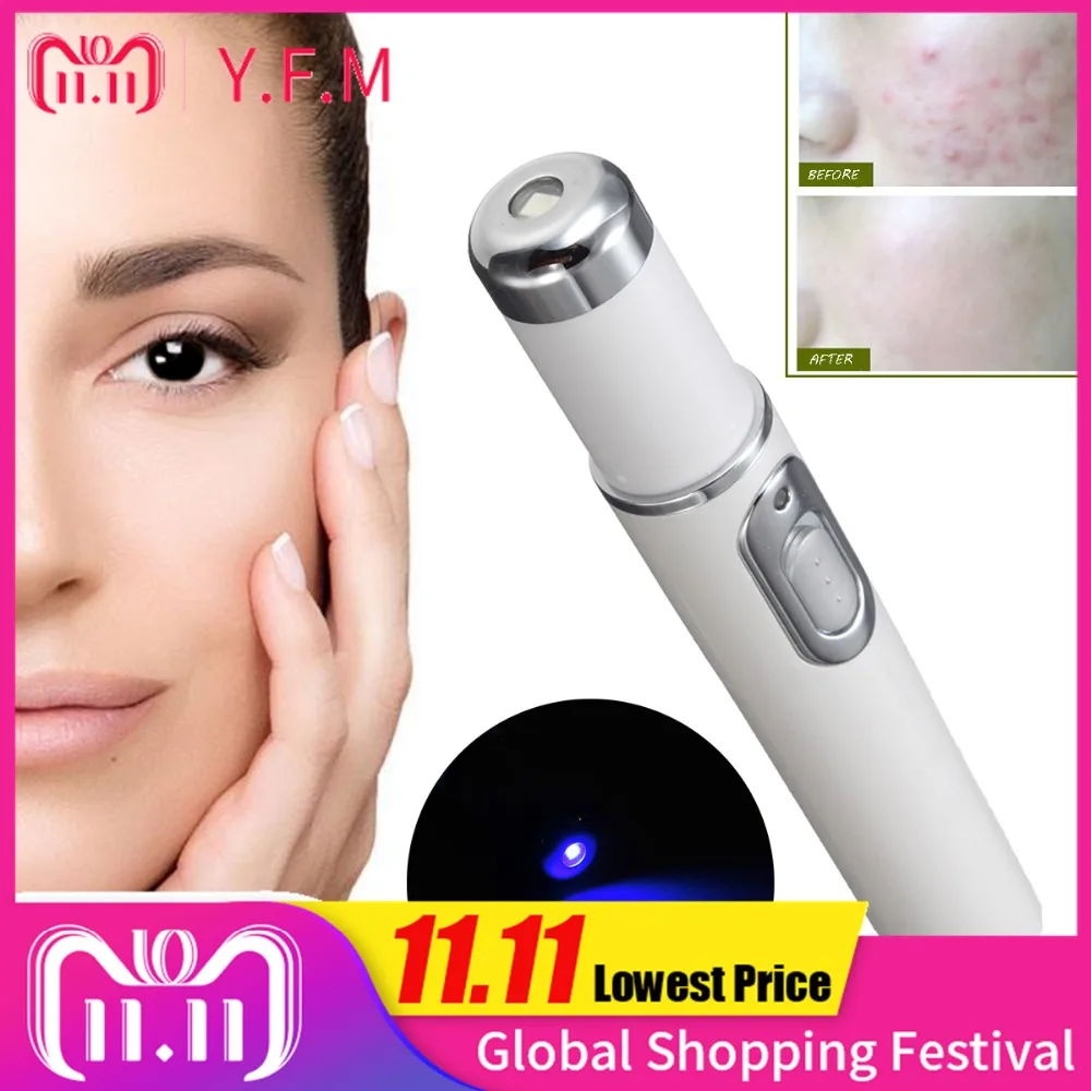 

Blue Light Therapy Acne Laser Pen Soft Scar Removal Tightening Pores Shrinking Anti-wrinkle Facial Skin Care Beauty Instrument