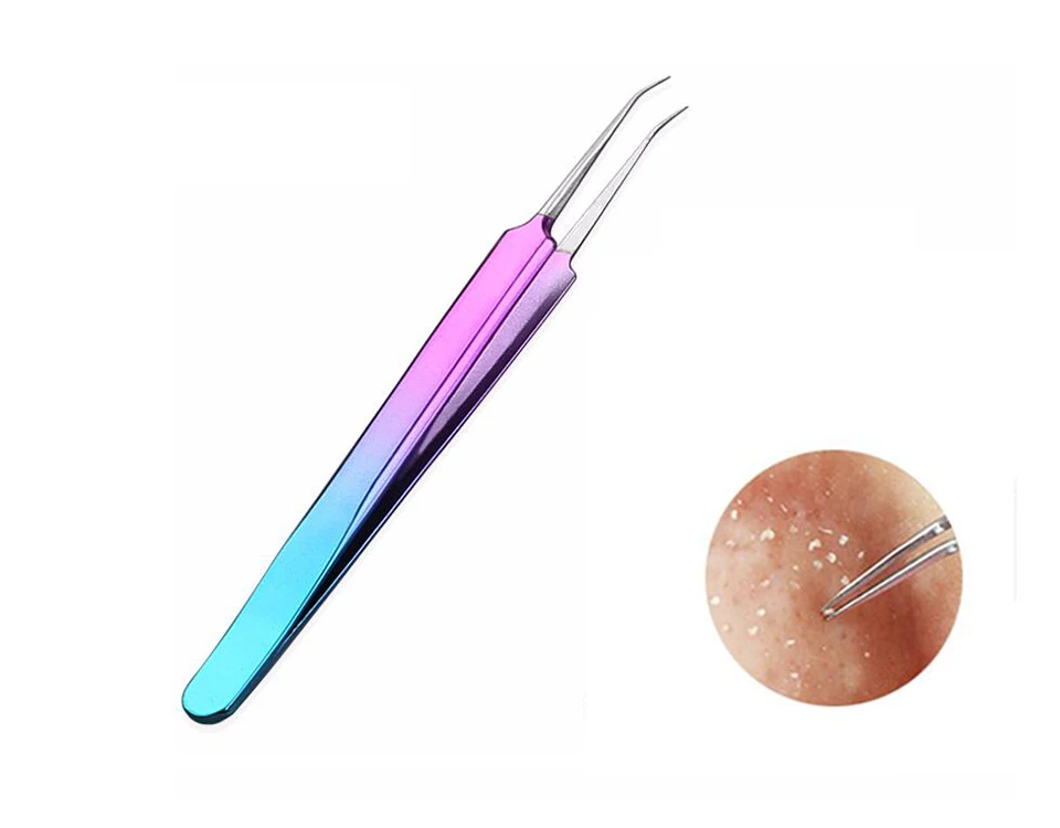 Acne tweezers (8)