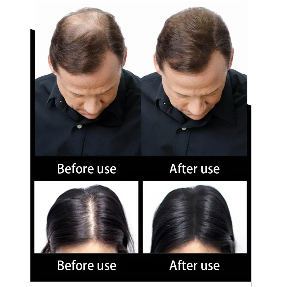 Прямая поставка Sevich Hair Fbers 25 г покрытие утонченные пакетировочные пятна