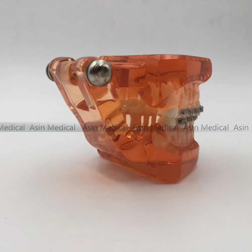 Modelo de Ortodontistas com Metal Dentista de Metal Alta Qualidade Novo Suportes Cerâmicos Ortopedia Paciente Estudante Aprendizagem Modelo 2020 & 8 Clareamento dos dentes