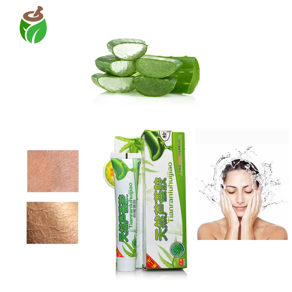 

2 Packs Anti Acne Pimple cure chinese eczena crean acne removal 100% natural solution Natural Aloe Vera Smooth Gel