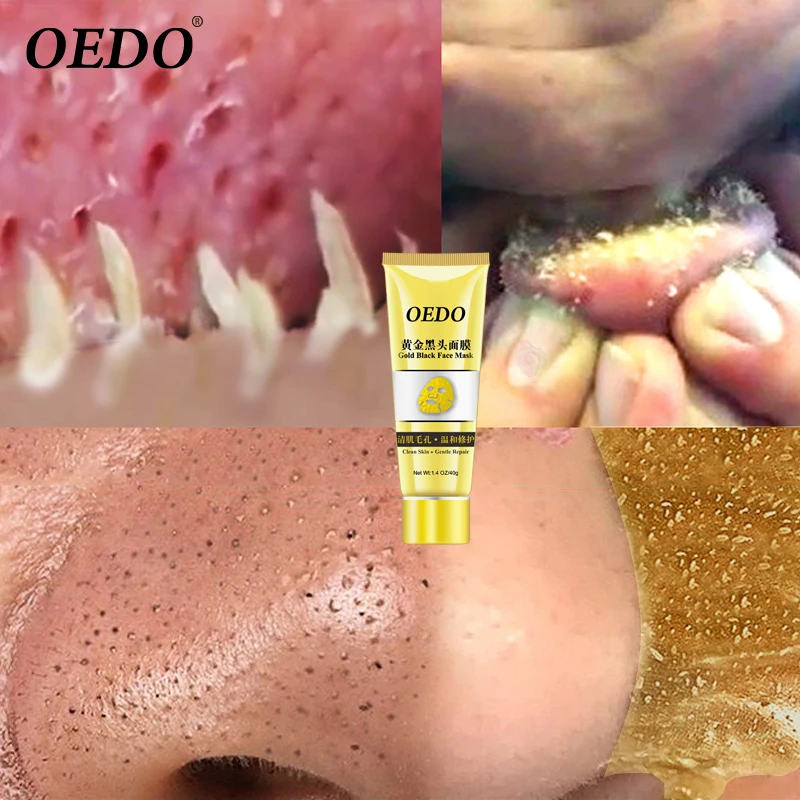 

OEDO Gold Remove Blackhead Mask Shrink Pore Improve Rough Skin Acne Shills Blackhead Remover Mask Facial Moisturizing Crea