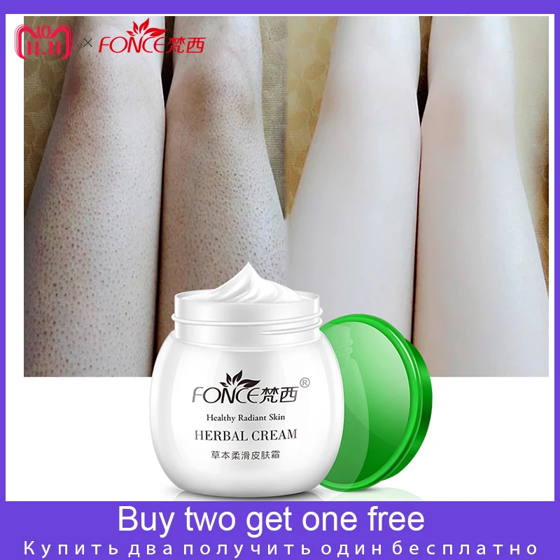 

Fonce Moisturizer Foot Cream Natural Malic acid Treatment Body ichthyosis vulgaris Darier Leg keratosis follicularis Cream