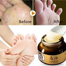 Крем для ног с лошадиным маслом, удаляющий запах берибери, 7 дней, лечение ног спортсмена, зуд, анти-раскалывание, пилинг, крем для ухода за ногами