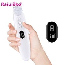 Портативный прибор для ухода за кожей лица с 4 наконечниками алмазное удаление дермабразии для постугревых рубцов пилинг для пор вакуумная машина отрицательного давления