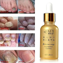 Регенерация ногтей Уход за ногтями полировочное масло гель грибок лечение онихомикоза ремонт