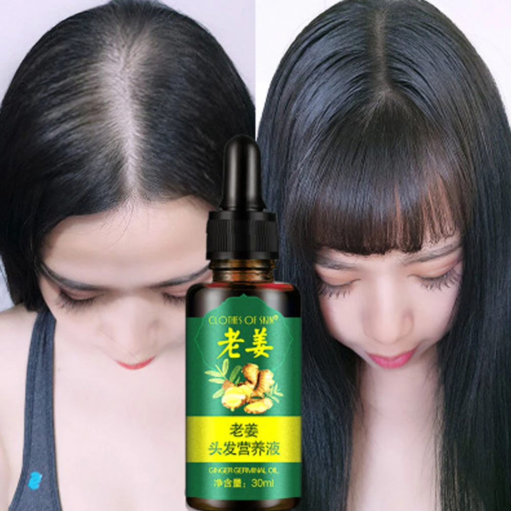 Pertumbuhan Rambut Minyak Jahe Pengobatan Rambut Rontok Serum Ekstrak Jahe Pertumbuhan Rambut Minyak Tumbuh Rambut Wajah Untuk Pria Wanita Perawatan Rambut Rontok Produk Aliexpress