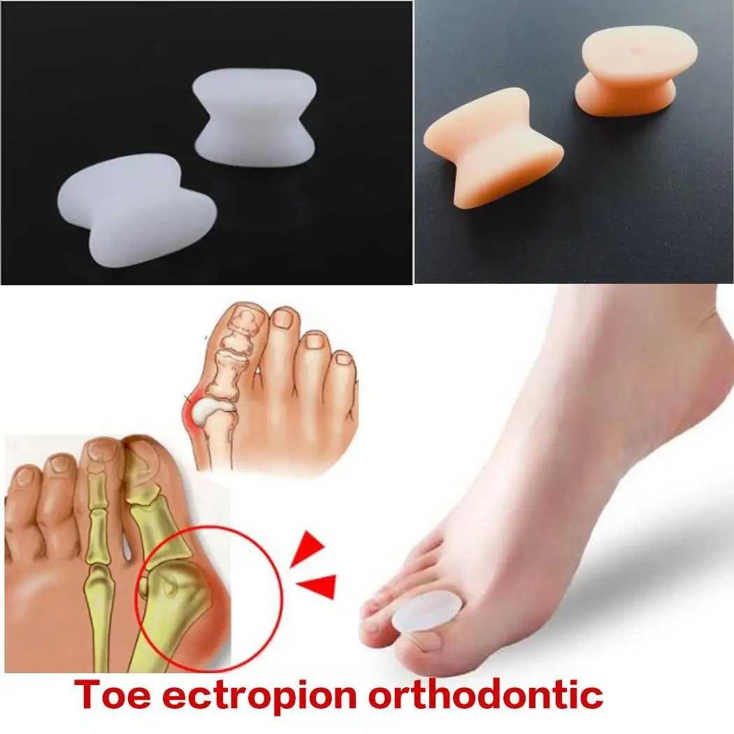 

Silicone Thumb Eversion Bigfoot Bone Overlap Correction 10-18g Bag Of White, Nude Toe Splitter